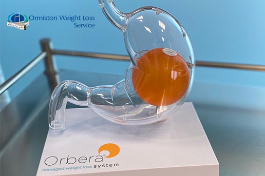 Supplement Oeganda Permanent Ormiston Weight Loss Service introducing the new Orbera B2B weight loss  balloon - Ormiston Hospital