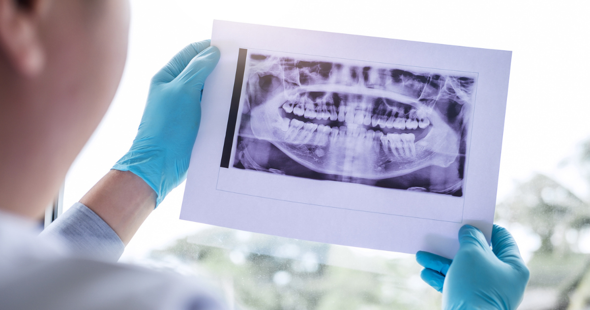 Oral & Maxillofacial surgeon holding up a X-ray of a mouth in preparation for oral surgery at Ormiston Hospital